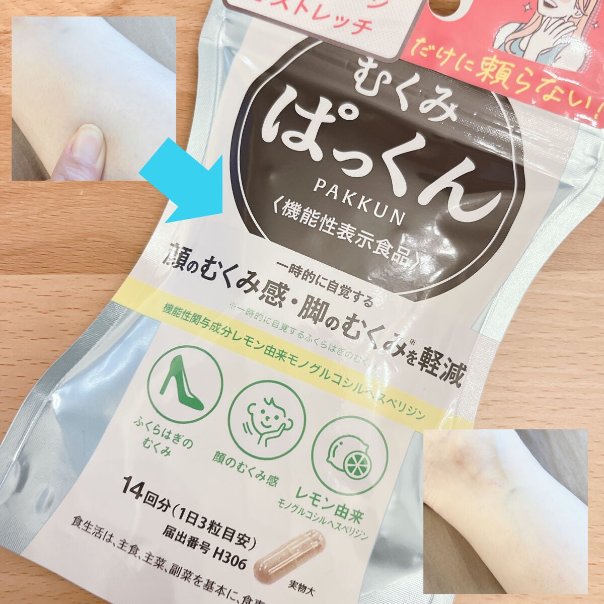 むくみぱっくん/スベルティ/健康サプリメントを使ったクチコミ(2枚目)