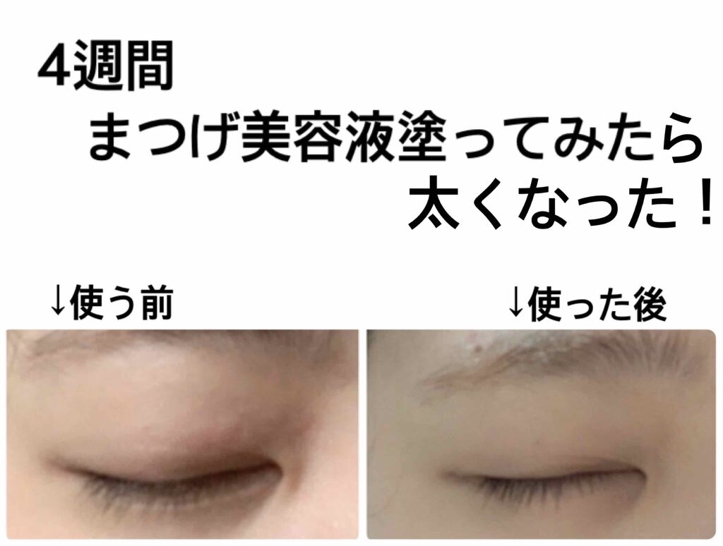 まつげ美容液EX/CEZANNE/まつげ美容液を使ったクチコミ(2枚目)
