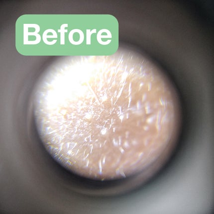 シカレチA クリーム0.05/VT/フェイスクリームを使ったクチコミ(2枚目)