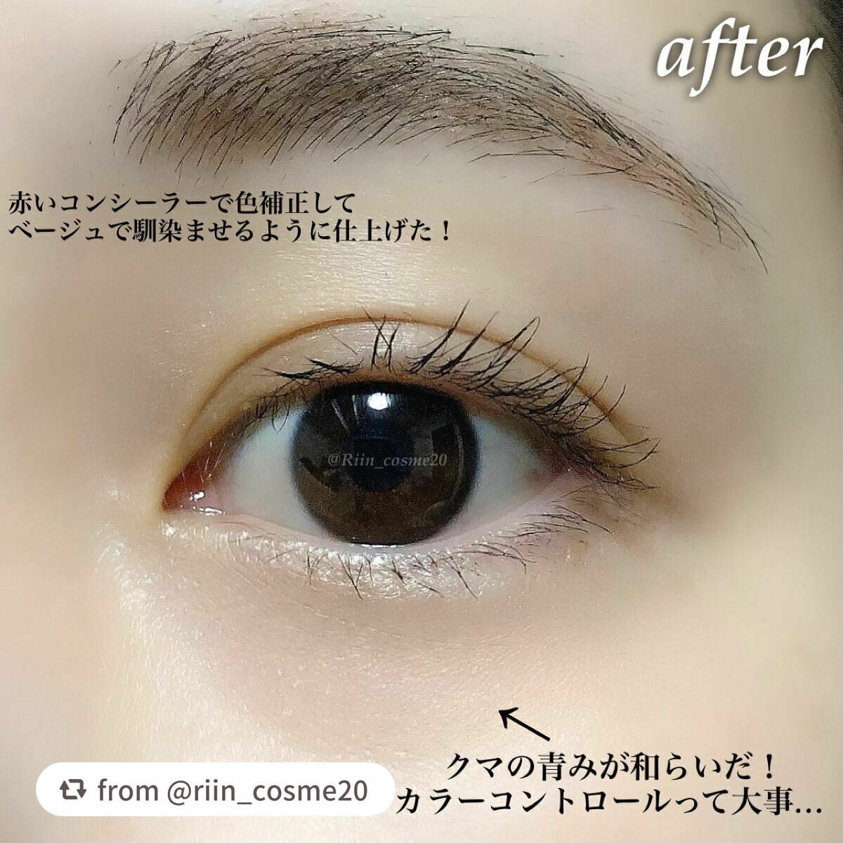 リシェ レッドトリック アイコンシーラー/Visée/パレットコンシーラーを使ったクチコミ(6枚目)