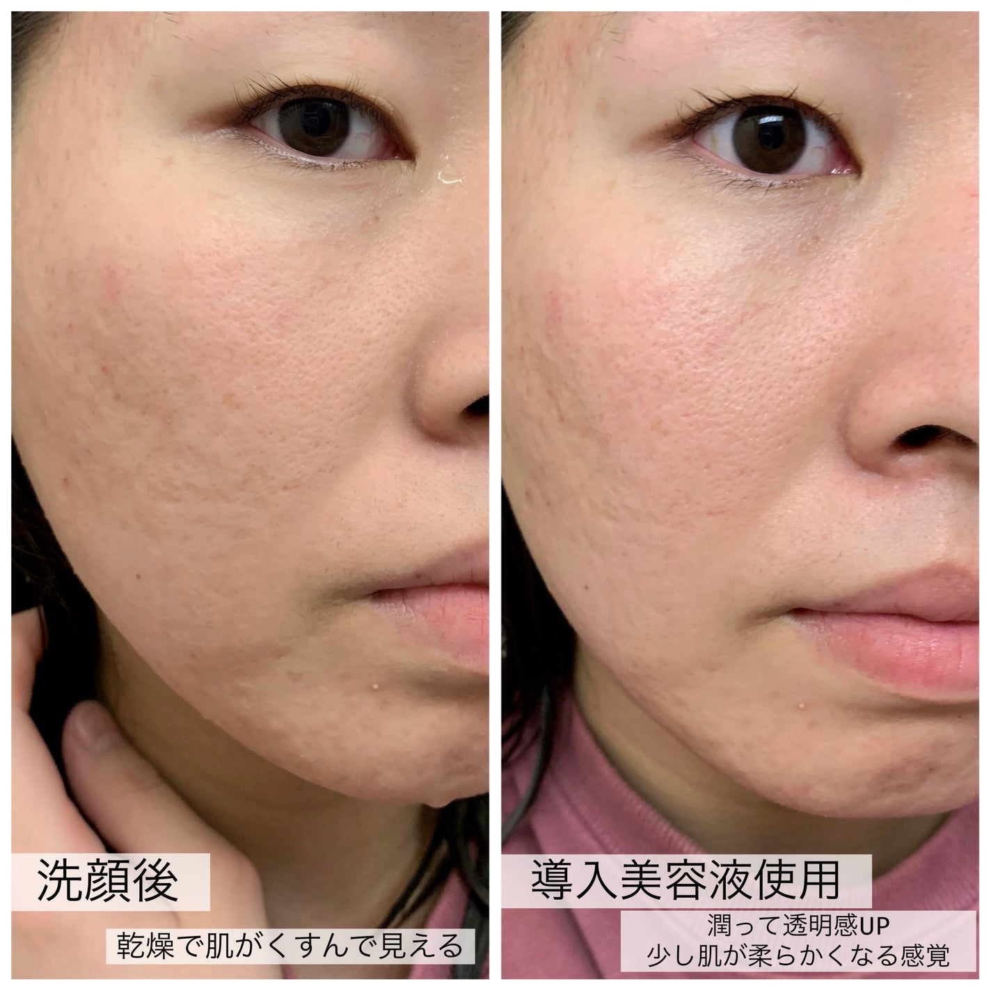 オイルインエッセンス/MUQURU/ブースター・導入液を使ったクチコミ(6枚目)