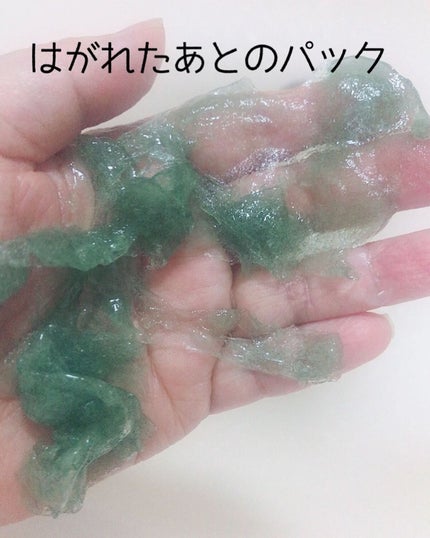 ニードル炭酸パック/NNE/洗い流すパック・マスクを使ったクチコミ(10枚目)