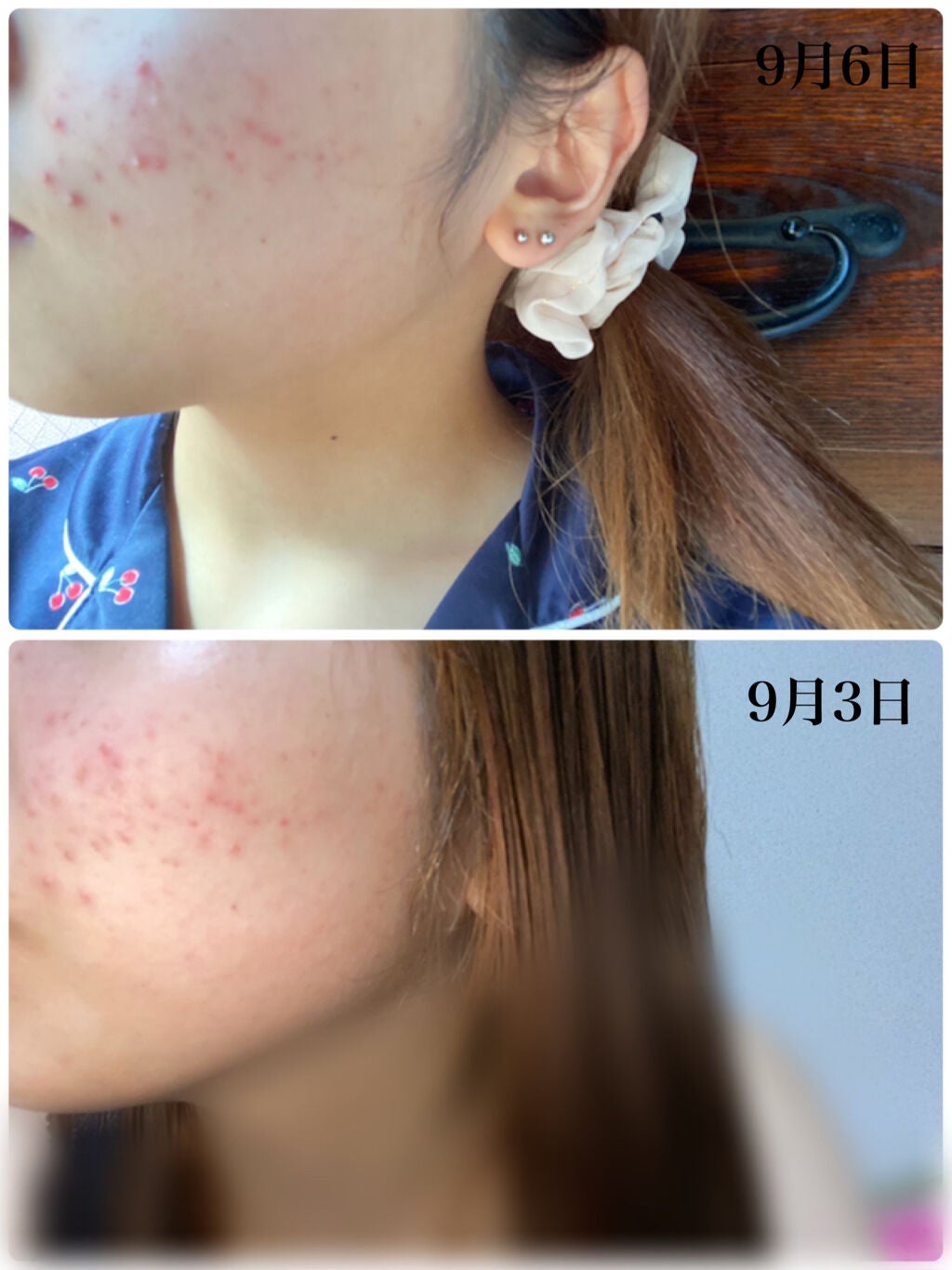 びふナイト/小林薬品/フェイスクリームを使ったクチコミ(1枚目)