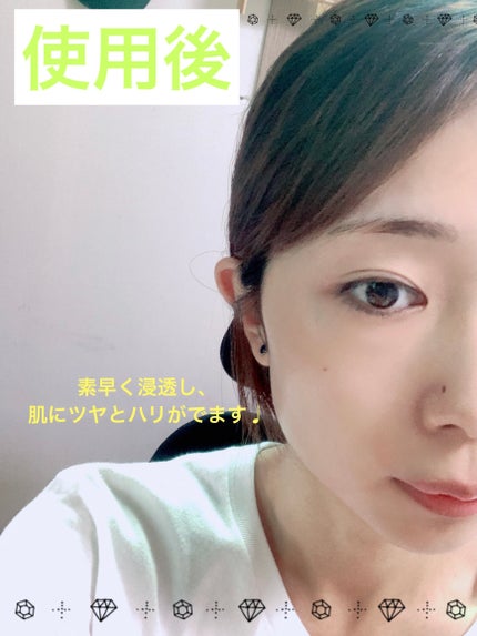 シグネチャーエストゥードプロテクター5.2/DEMAR3/美容液を使ったクチコミ(5枚目)