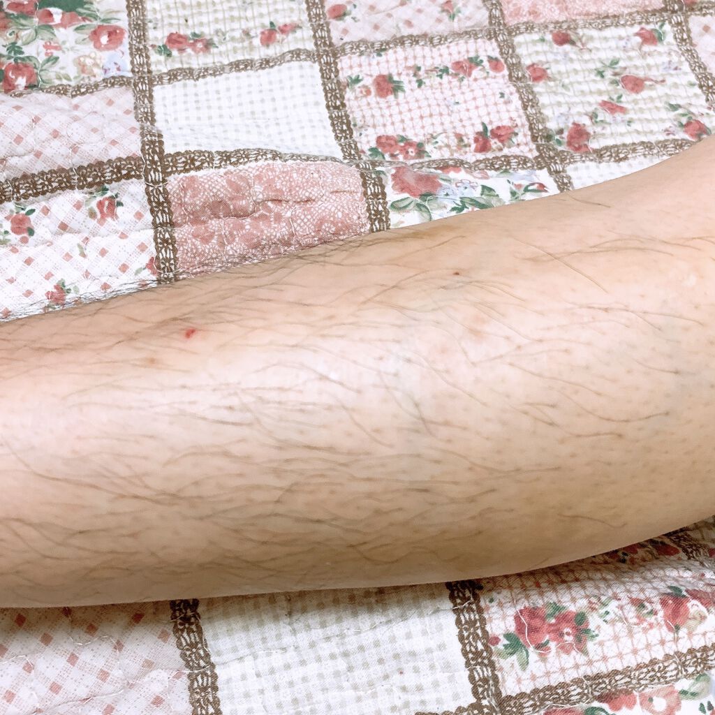 NONON/NONON(ノンノン)/除毛クリームを使ったクチコミ（3枚目）