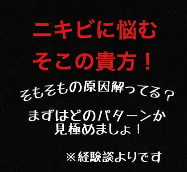 はい、mintoです♡

今日は、私の経験談から
ニキビに悩む乙女たちの手助けが出来たらな…と思い、投稿をスタートしました！


私は小学5年からニキビができ始め、
中高もどうしていいか分からず…😭

