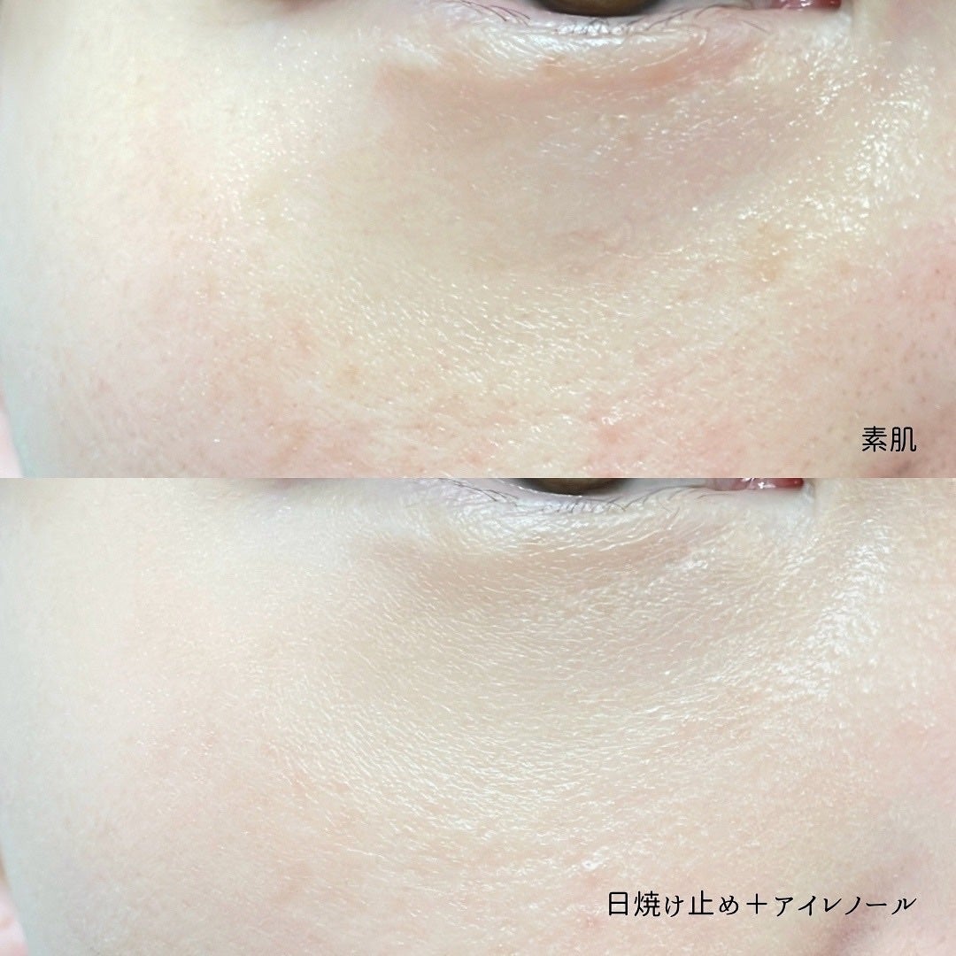 アイレノール クマクリーム/IRENOL/アイケア・アイクリームを使ったクチコミ(4枚目)