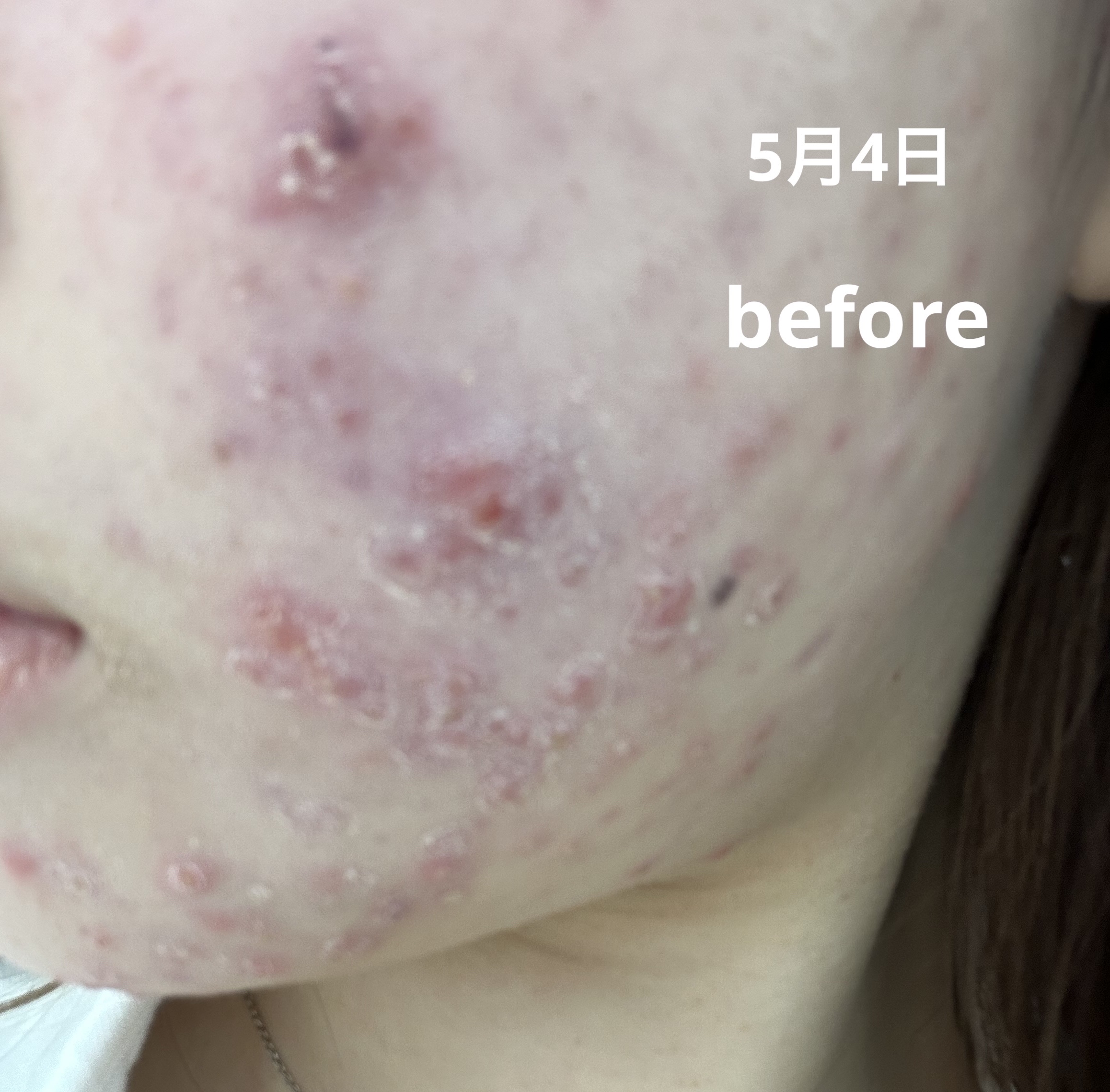 明色美顔水 薬用化粧水/美顔/化粧水を使ったクチコミ（3枚目）