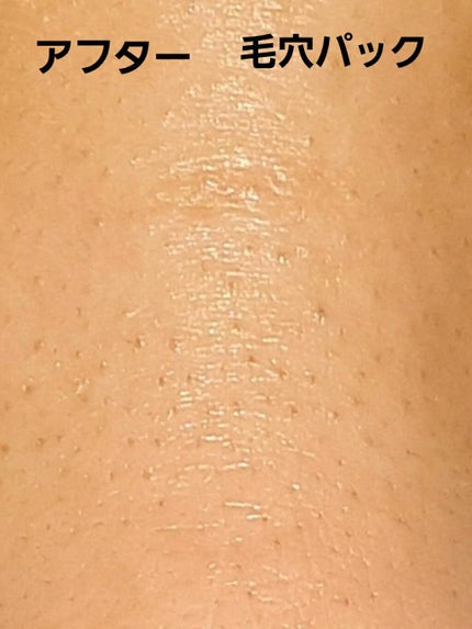 ロゼットゴマージュ/ロゼット/ピーリングを使ったクチコミ(4枚目)