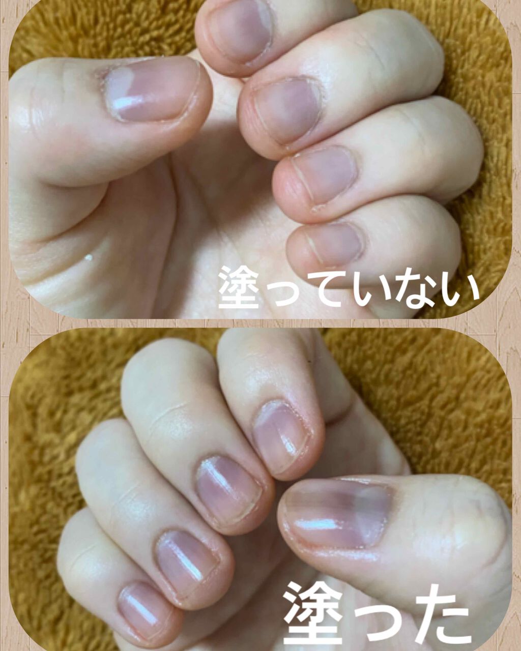 エテュセ クイックケアコート/ettusais/ネイルオイル・トリートメントを使ったクチコミ(1枚目)