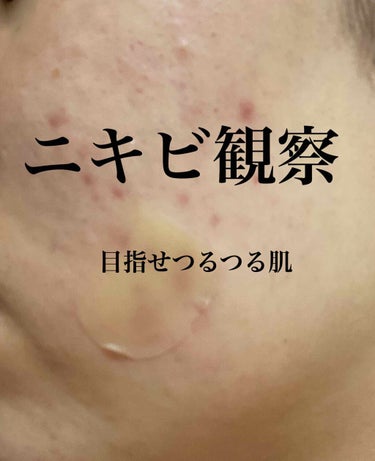 敏感肌用薬用美白美容液/無印良品/美容液を使ったクチコミ（1枚目）