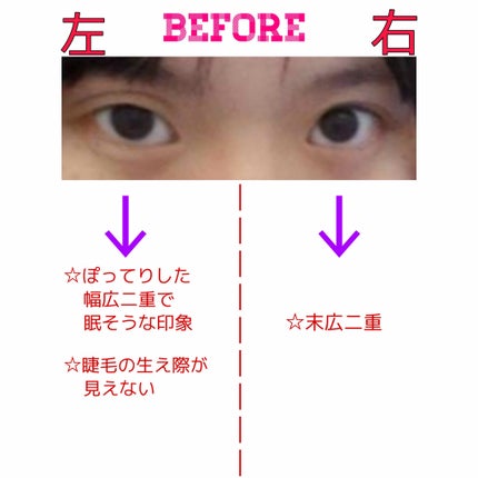 アイテープ(絆創膏タイプ、レギュラー、70枚)/DAISO/二重まぶた用アイテムを使ったクチコミ(2枚目)