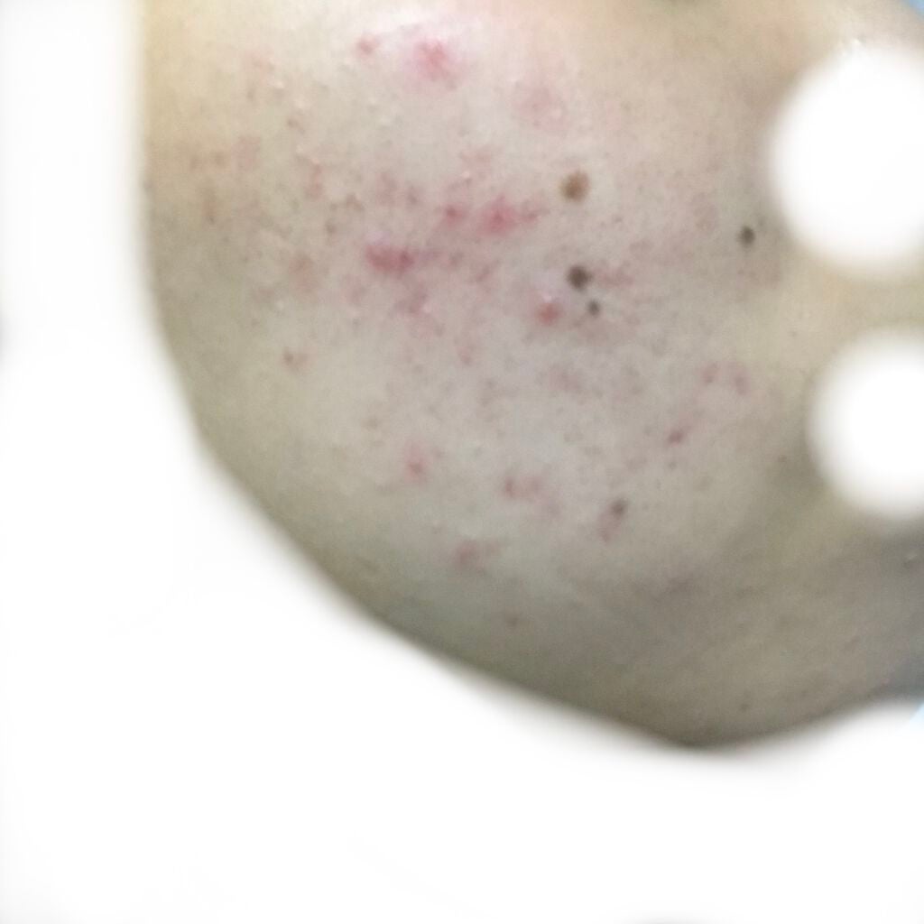 デュオ ザ クレンジングバーム クリア/DUO/クレンジングバームを使ったクチコミ(2枚目)