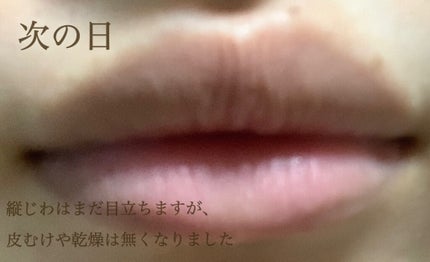 リップスリーピングマスク/LANEIGE/リップバームを使ったクチコミ(6枚目)