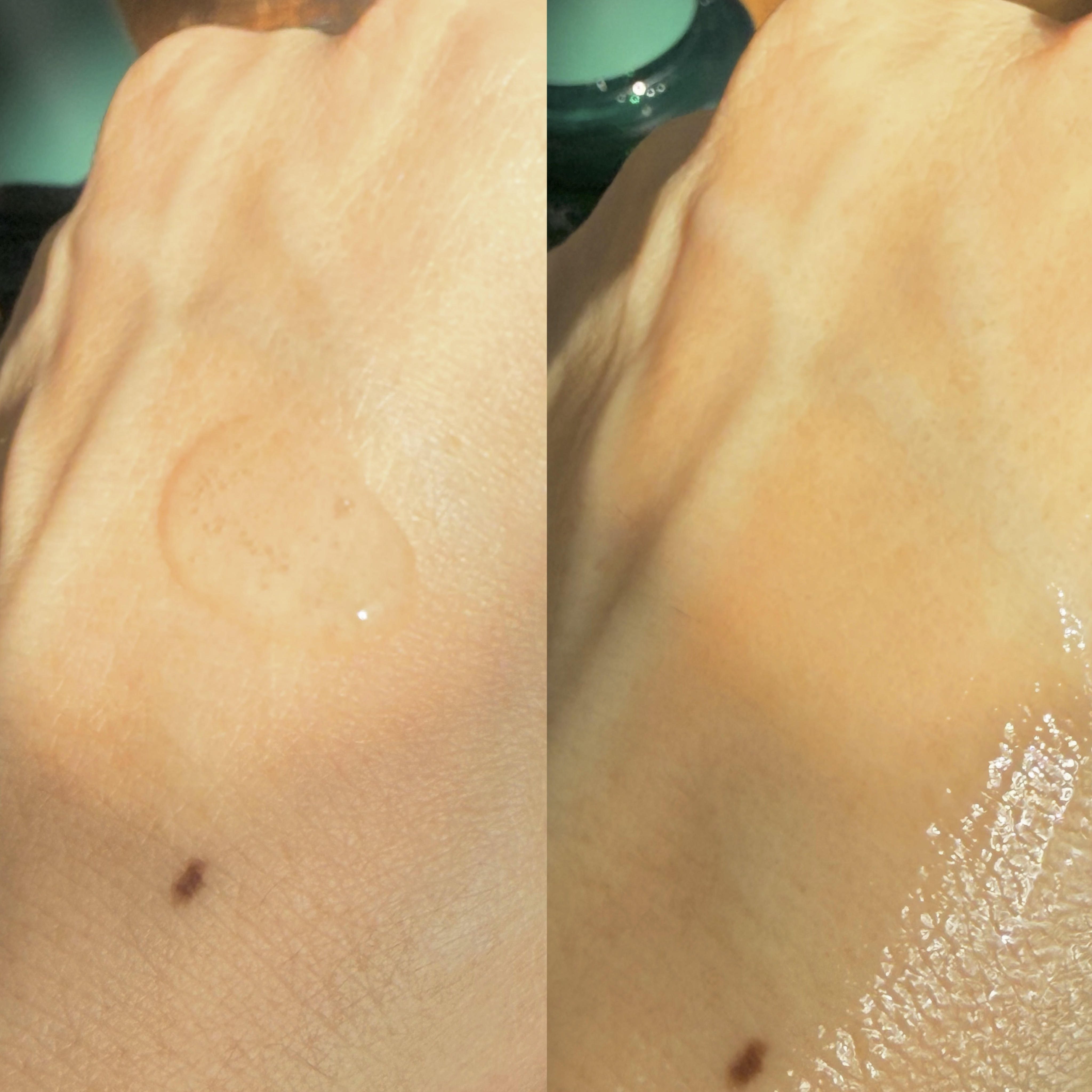 CICA&Dokudamiナチュラルセラム/leam/美容液を使ったクチコミ（3枚目）