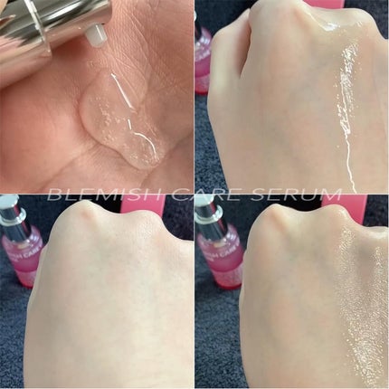 ブレミッシュケアアップ セラム/ISOI/美容液を使ったクチコミ(5枚目)