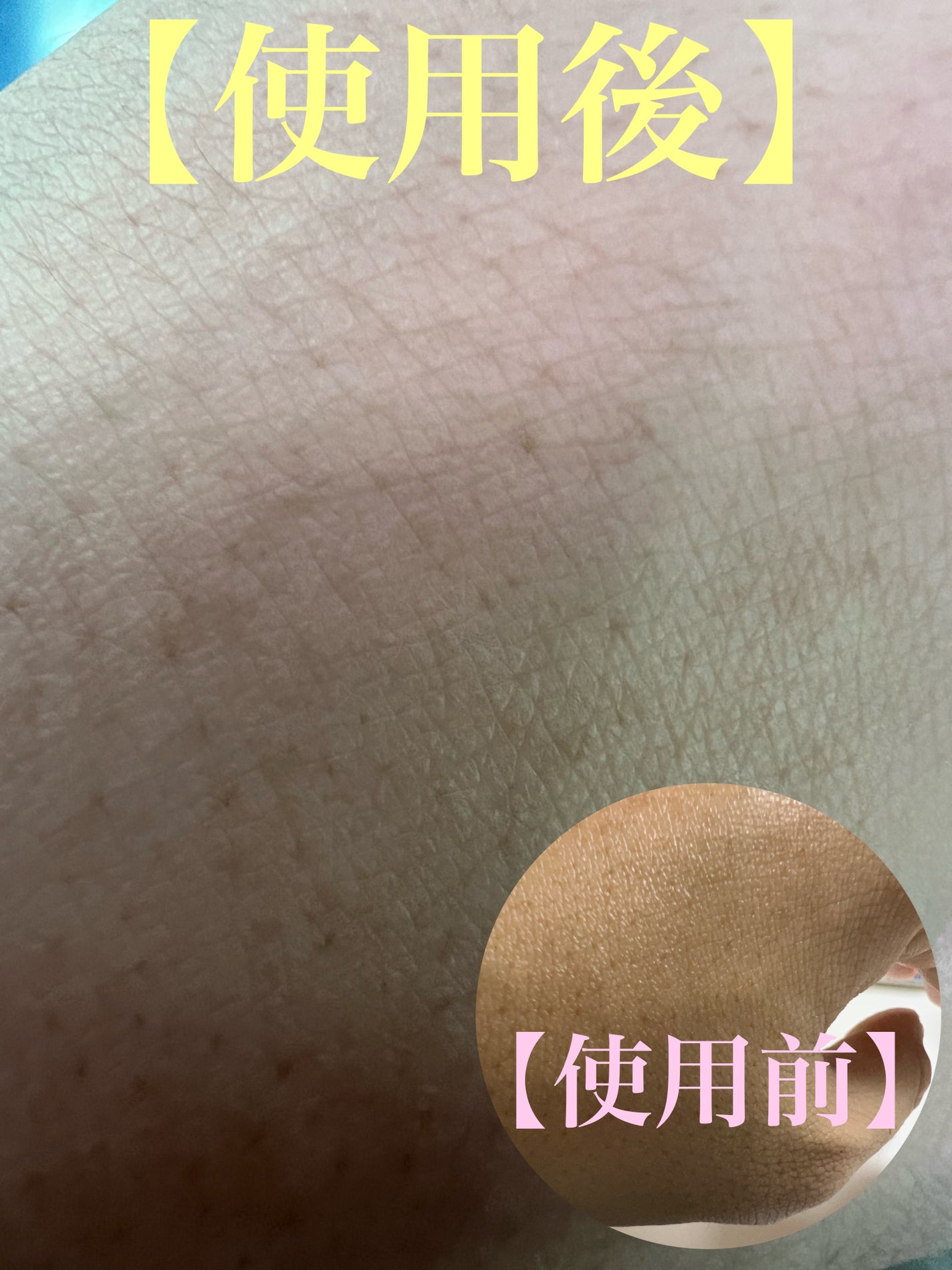 レチノール スーパーバウンス セラム/IOPE/美容液を使ったクチコミ(4枚目)