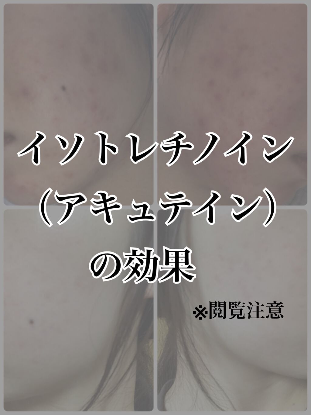 サンシビオ エイチツーオー D/ビオデルマ/クレンジングウォーターを使ったクチコミ(1枚目)