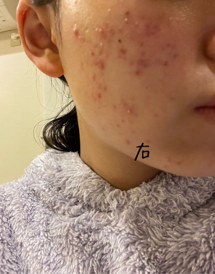 ã䜿ã£ãã¯ãã³ãïŒ1æç®ïŒ