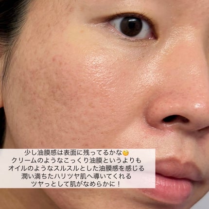 N organic Basic コンディショニング VCエッセンス/N organic/美容液を使ったクチコミ(7枚目)