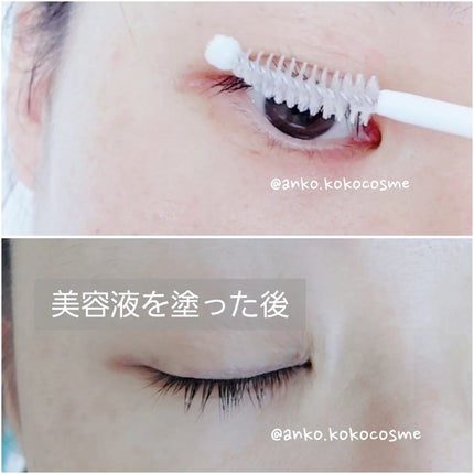 あんこ♡フォロバ100 on LIPS 「ヴィーガンのまつ毛美容液BERRISOMVEGANBIOTH..」(5枚目)