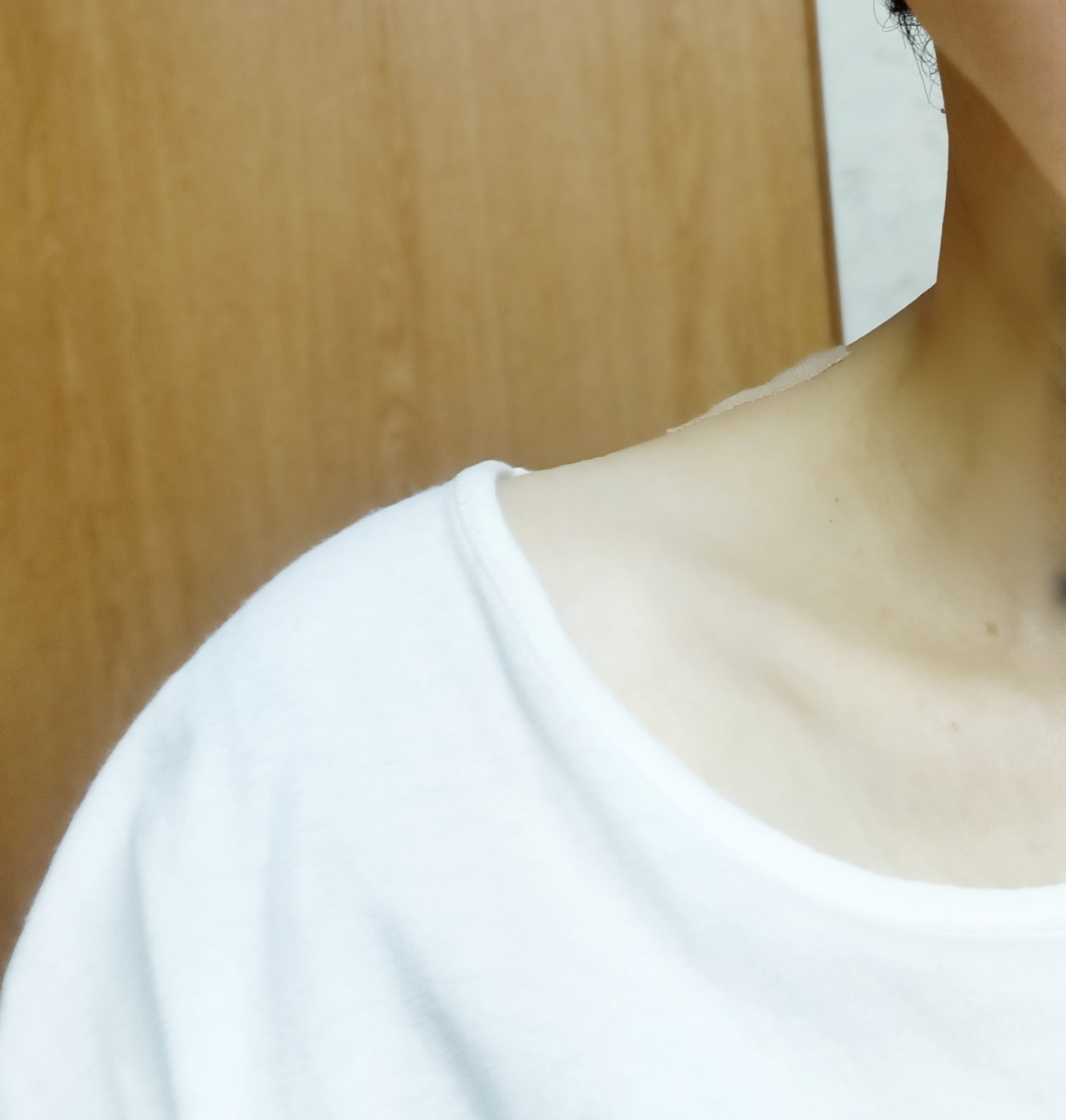 キネシオロジーテープ/ドームメディカル/その他を使ったクチコミ（3枚目）