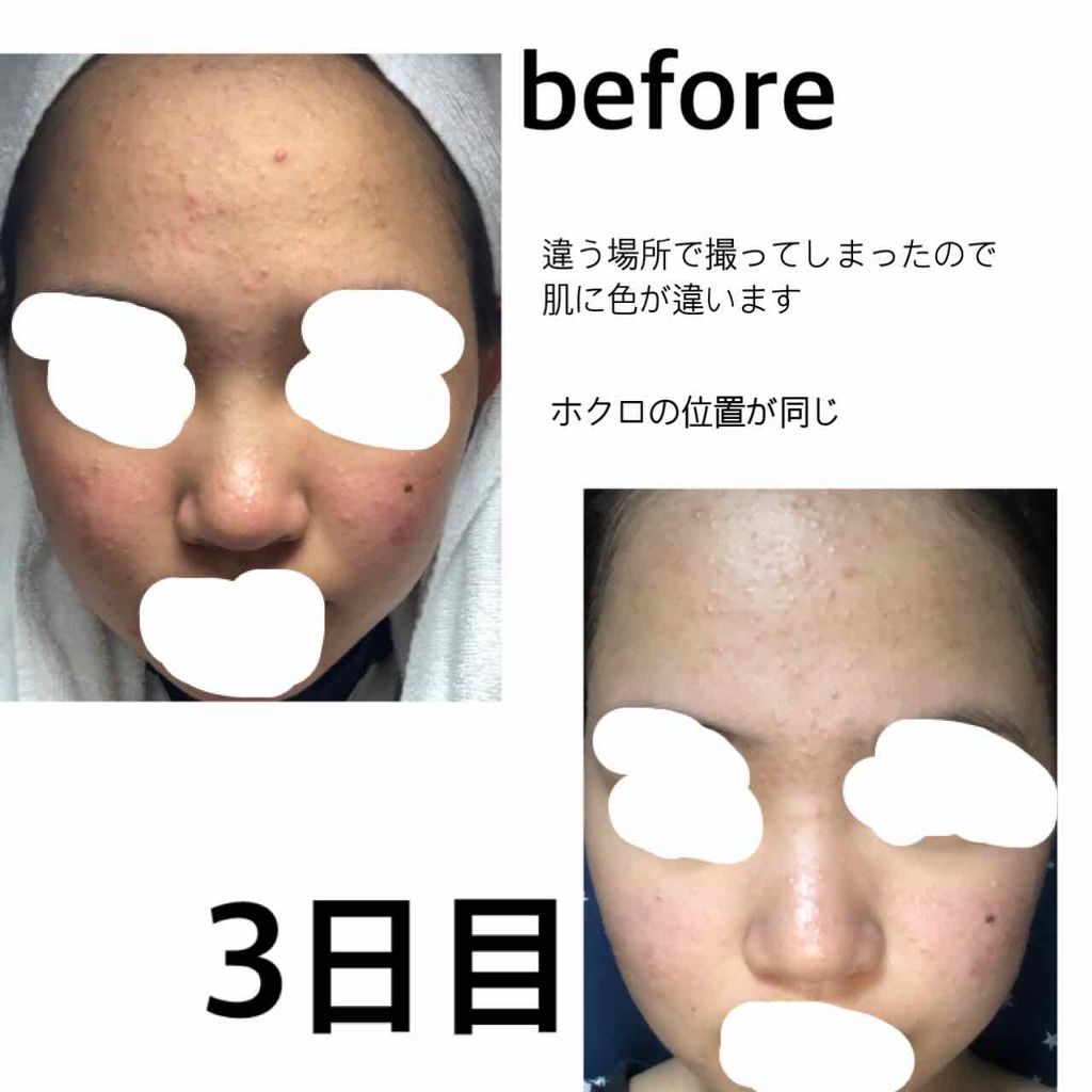 ワンステップオリジナルクリアパッド/COSRX/トナーパッドを使ったクチコミ(2枚目)