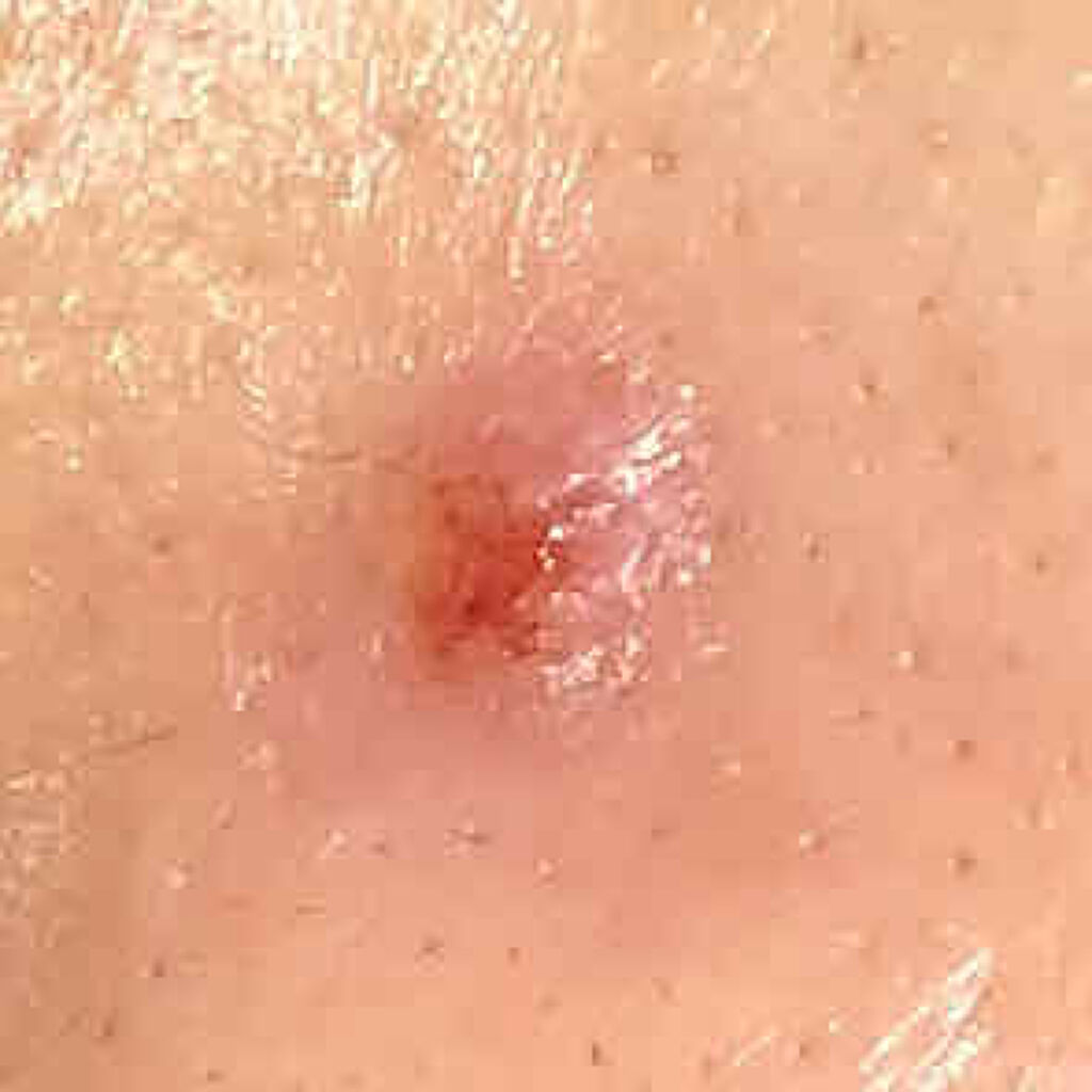 ネイチャーコンク 薬用クリアローション/ネイチャーコンク/拭き取り化粧水を使ったクチコミ（3枚目）