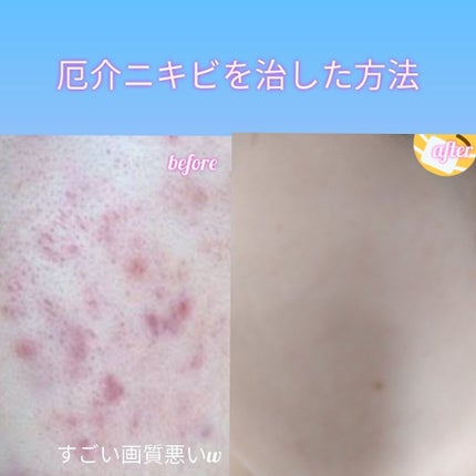 明色美顔水 薬用化粧水/美顔/化粧水を使ったクチコミ(1枚目)