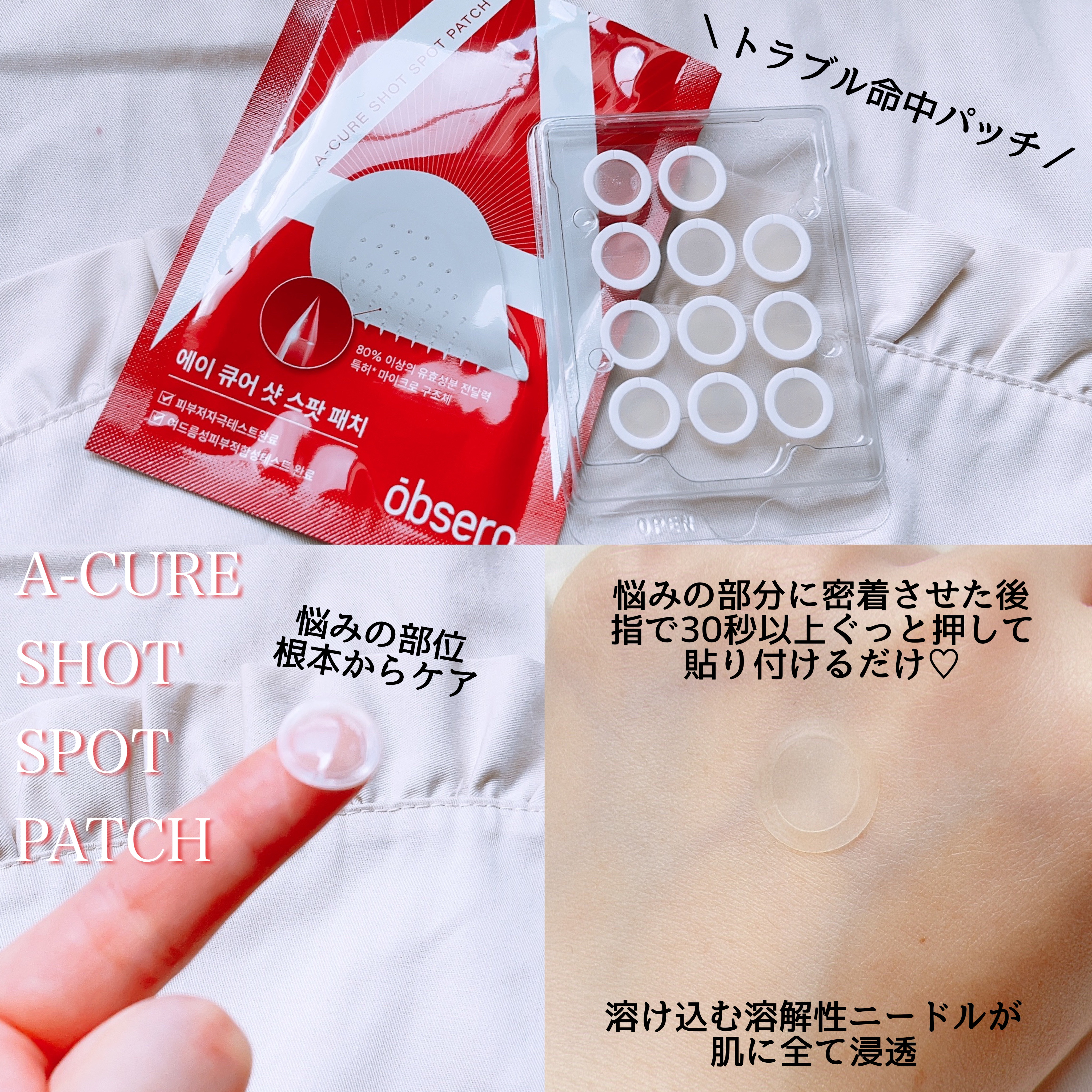 エーキュアショットスポットパッチ/obsero/にきびパッチを使ったクチコミ（3枚目）