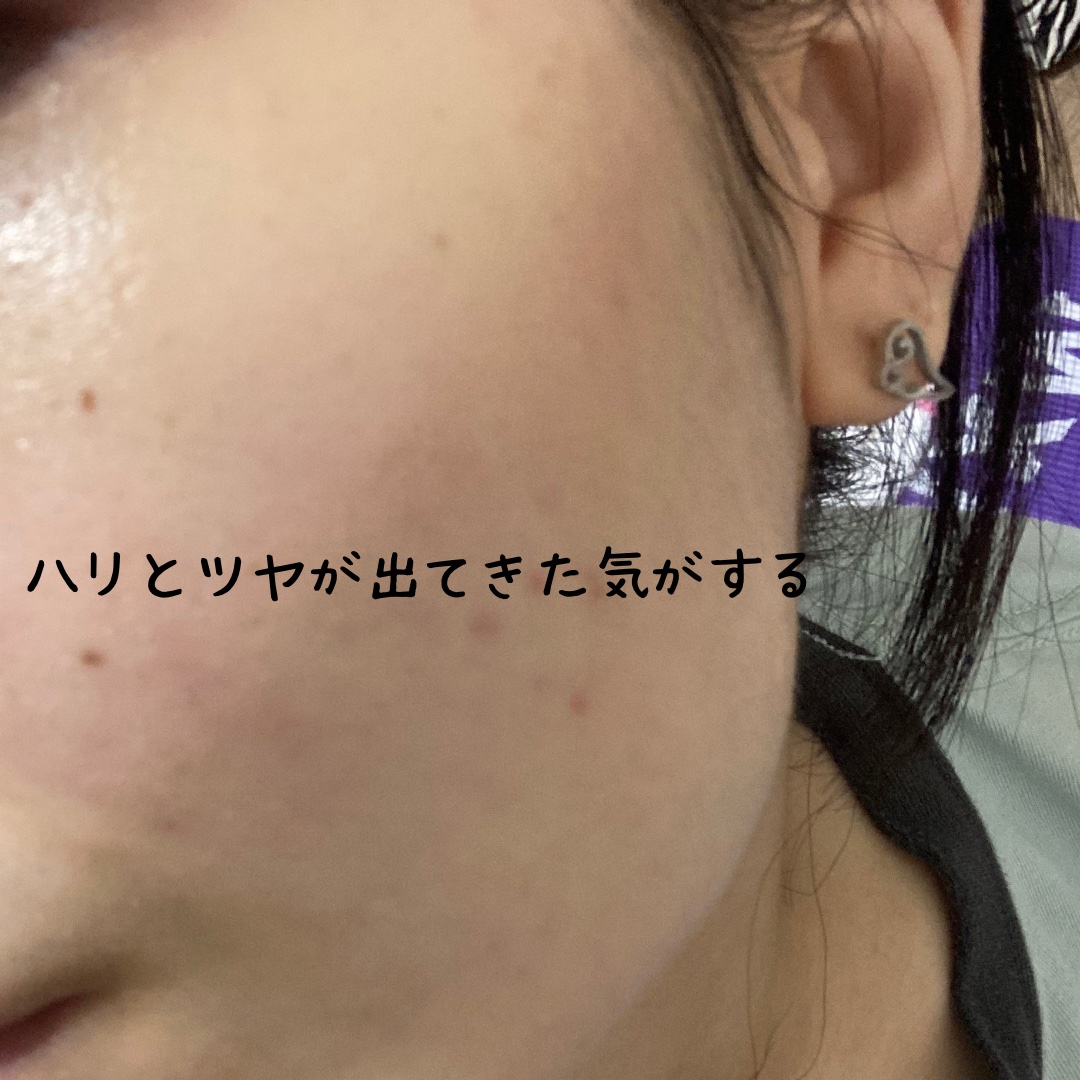 REVERSAL DROP/fonskin/美容液を使ったクチコミ（3枚目）