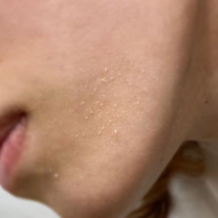 レチノールインテンシブ アドバンスドトリプルアクションアイクリーム/SOME BY MI/アイケア・アイクリームを使ったクチコミ(5枚目)