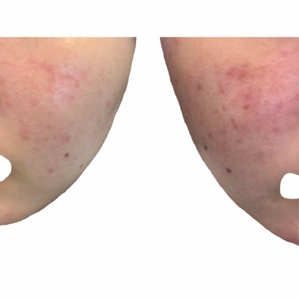 CICA クリーム/VT/フェイスクリームを使ったクチコミ(2枚目)