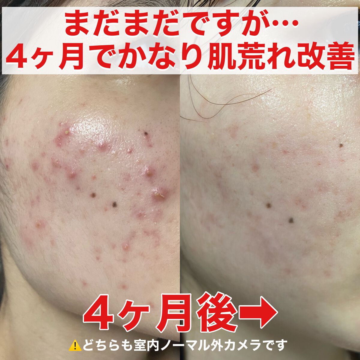 ビオオイル アルガンオイル/Melvita/フェイスオイルを使ったクチコミ（1枚目）