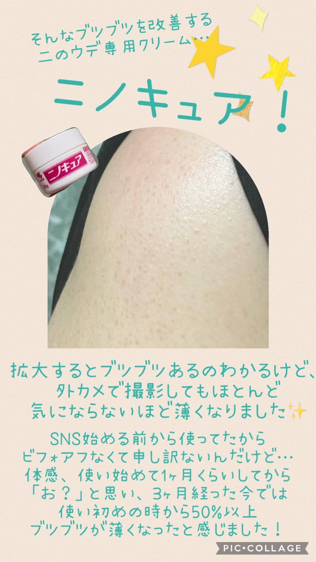 ニノキュア（医薬品）/ニノキュア/その他を使ったクチコミ（3枚目）