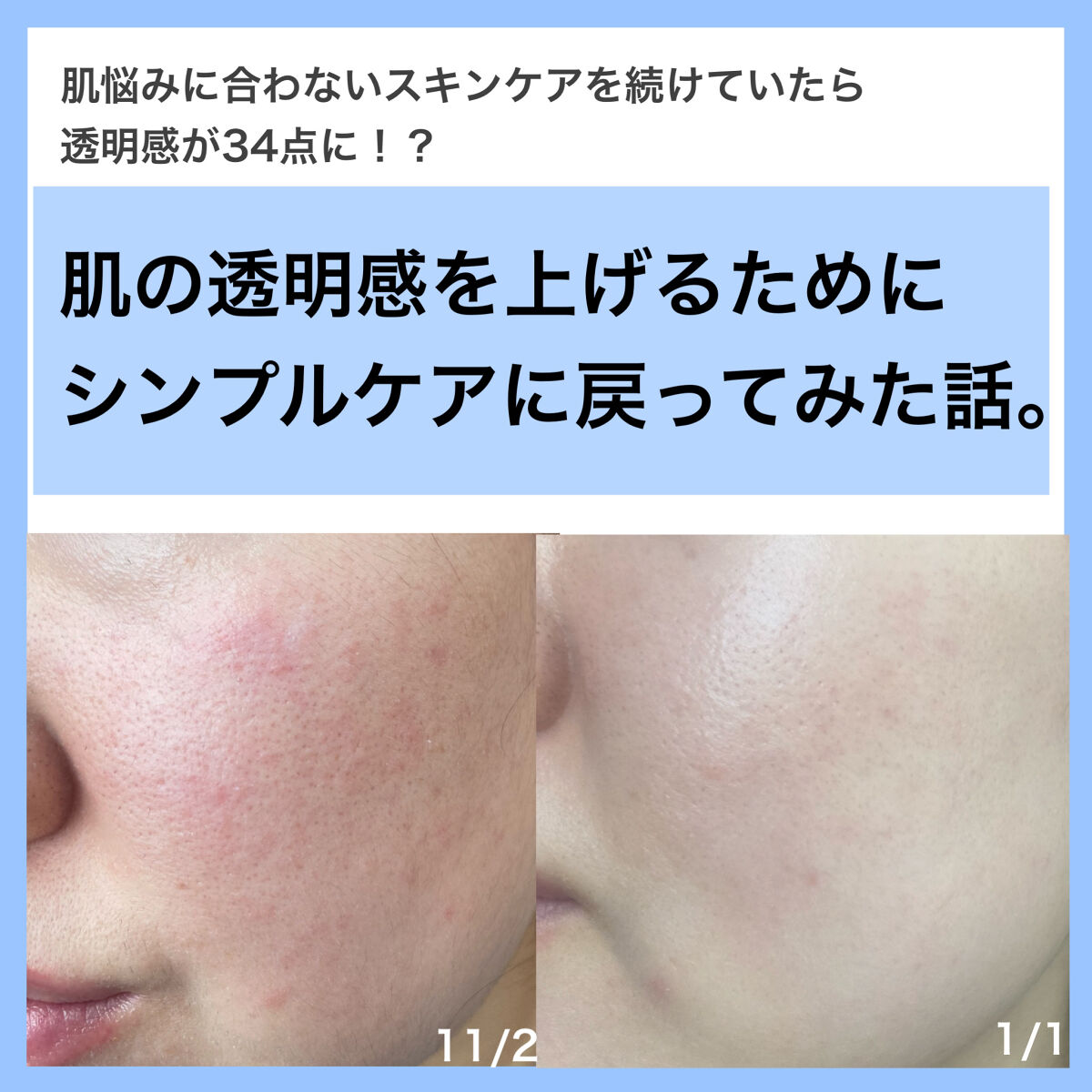 モイスチュア ローション/カルテHD/化粧水を使ったクチコミ（1枚目）