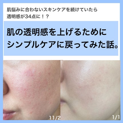 モイスチュア ローション/カルテHD/化粧水を使ったクチコミ(1枚目)