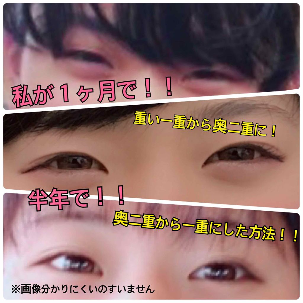 アイテープ 絆創膏タイプ レギュラー 70枚 Daisoの口コミ 超優秀 100均で買えるおすすめ二重まぶた用アイテム 初投稿 初めまして なだ です By なだ 脂性肌 10代後半 Lips アイテープ 絆創膏タイプ レギュラー 70枚 Daisoの口コミ 超優秀 100均で買えるおすすめ二重まぶた用アイテム 初投稿 初めまして なだ です By なだ 脂性肌 10代後半 Lips