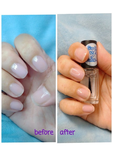 ネイルホリック Top coat/ネイルホリック/ネイルトップコートを使ったクチコミ(5枚目)
