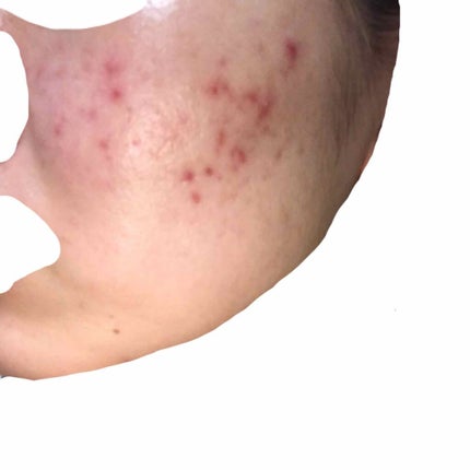 オリジナル ピュアスキンジェリー/ヴァセリン/ボディクリームを使ったクチコミ(3枚目)