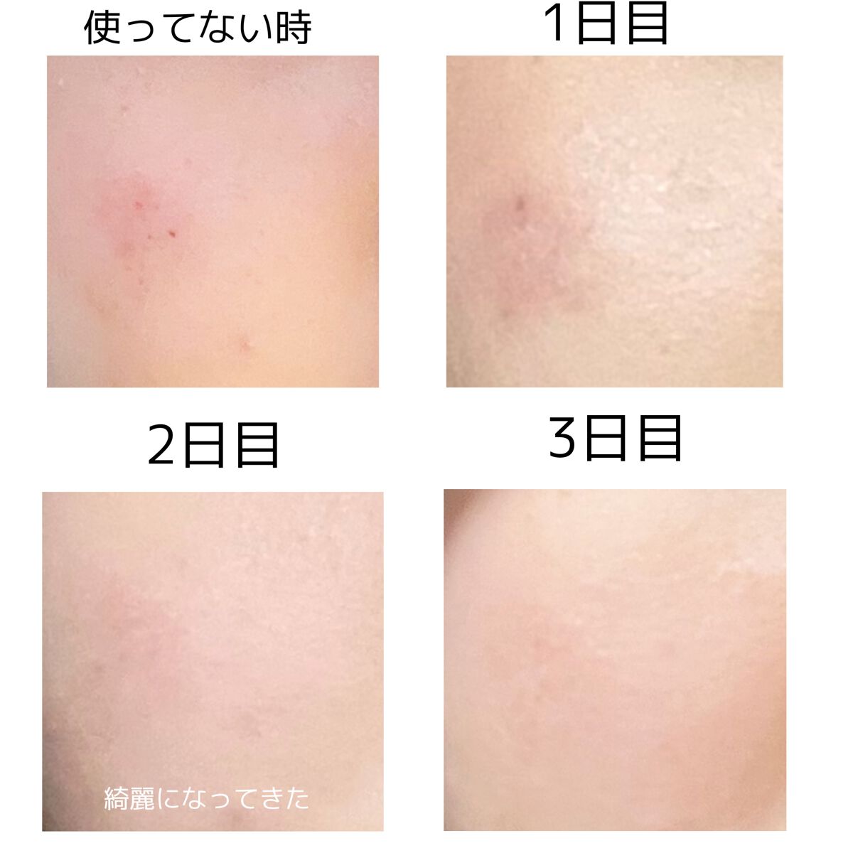 化粧水・敏感肌用・高保湿タイプ/無印良品/化粧水を使ったクチコミ(2枚目)