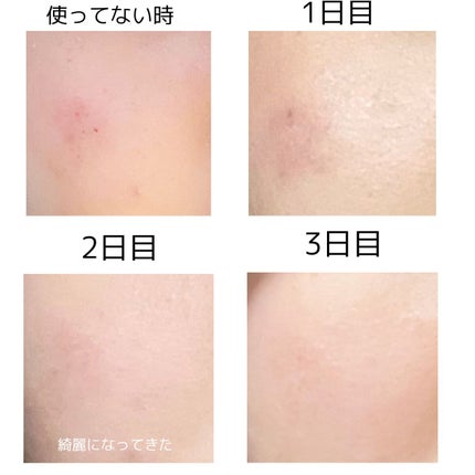 化粧水・敏感肌用・高保湿タイプ/無印良品/化粧水を使ったクチコミ(2枚目)