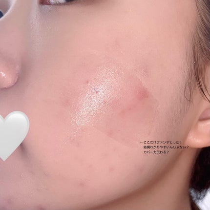 ダブル セラム バーム ファンデーション/Dr.Althea/クリーム・エマルジョンファンデーションを使ったクチコミ(4枚目)