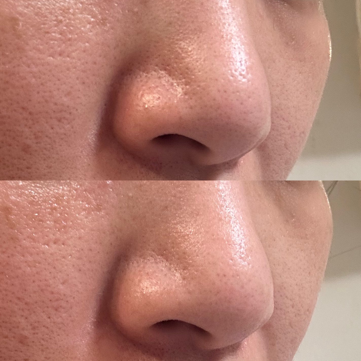 アンチポアブラックヘッドパーフェクトクリアキット/CNP Laboratory/シートマスク・パックを使ったクチコミ(4枚目)