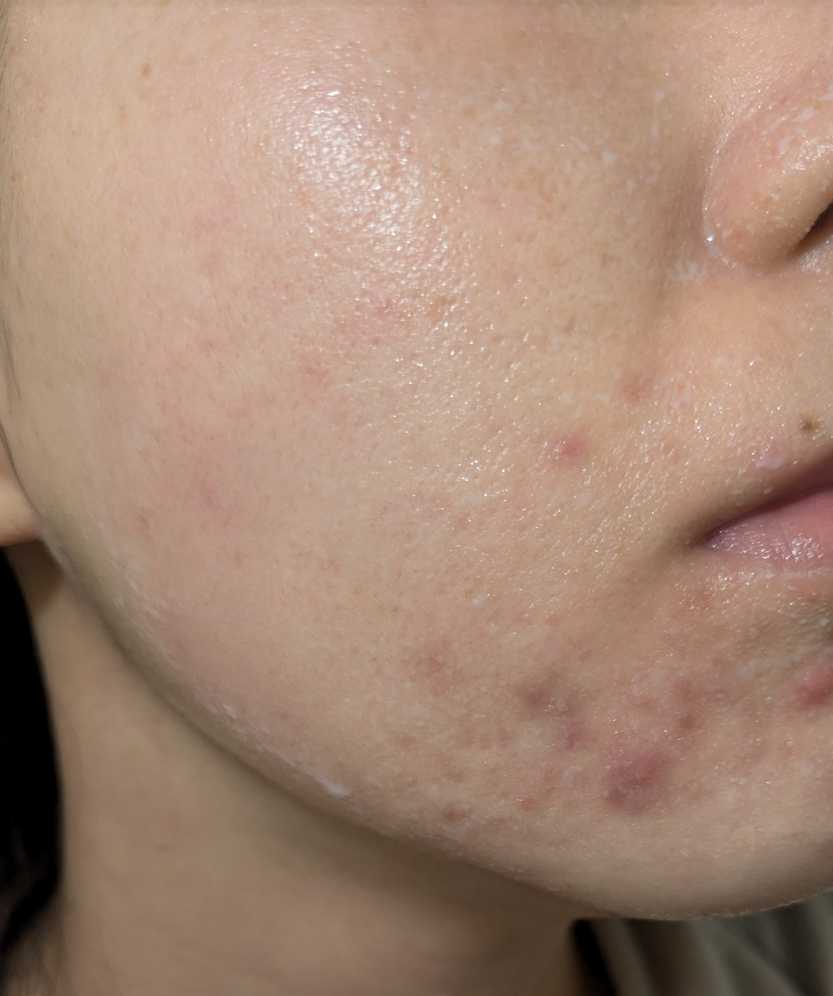 11/18の#汚肌工事録

😂