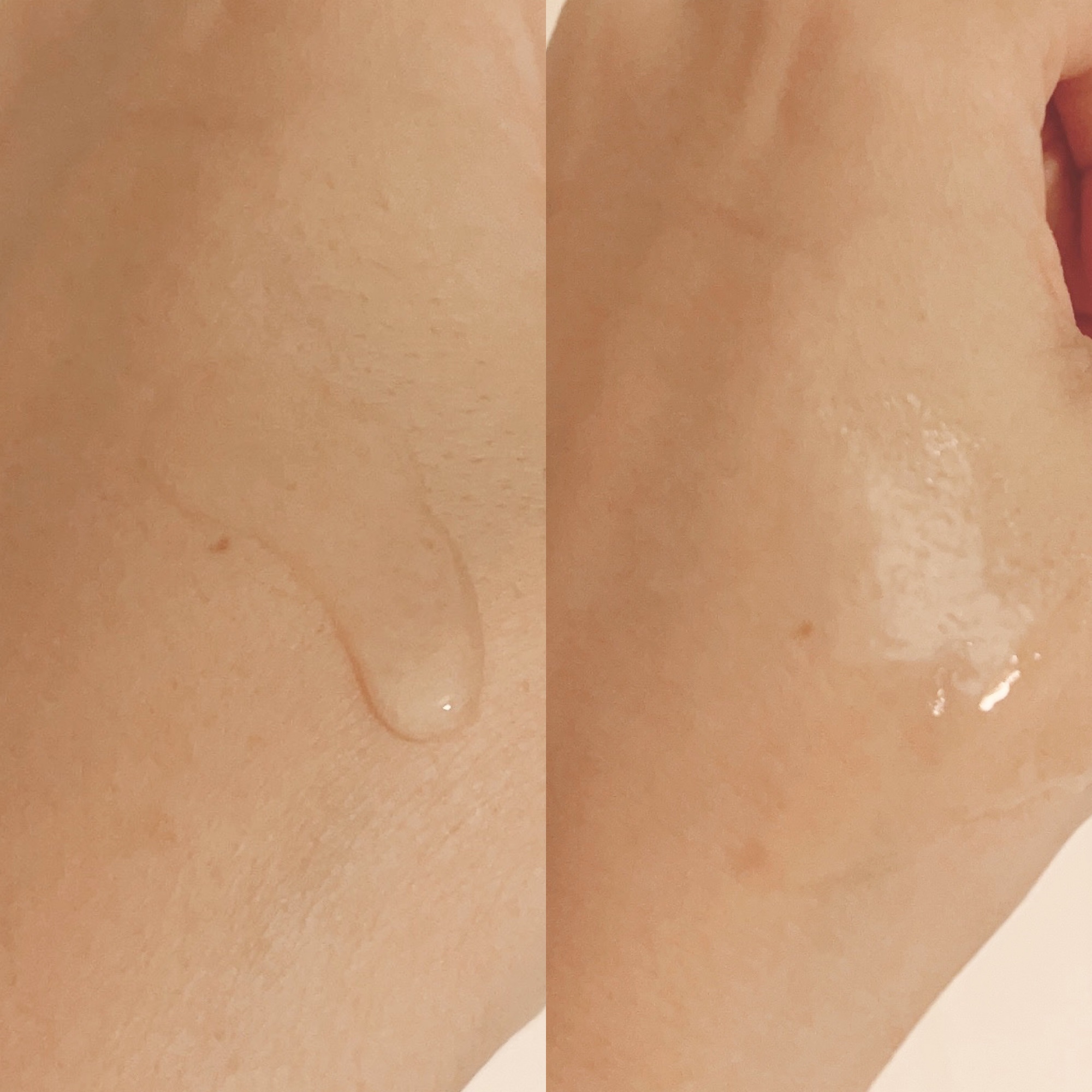 F. Repair Serum/Ferne/美容液を使ったクチコミ（3枚目）