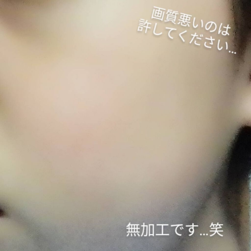 薬用化粧水/スキンライフ/化粧水を使ったクチコミ(2枚目)