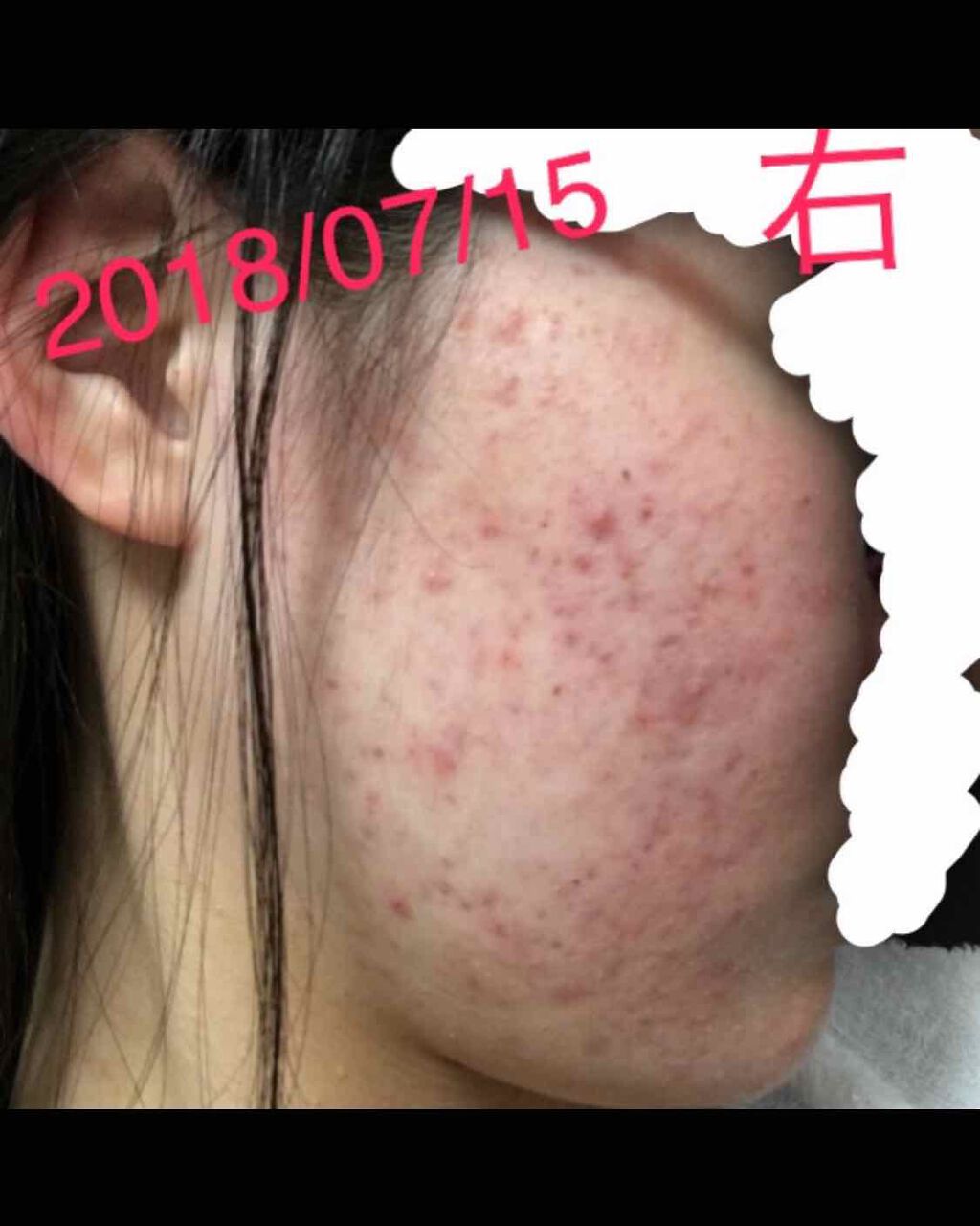 ハトムギ化粧水(ナチュリエ スキンコンディショナー R )/ナチュリエ/化粧水を使ったクチコミ(1枚目)