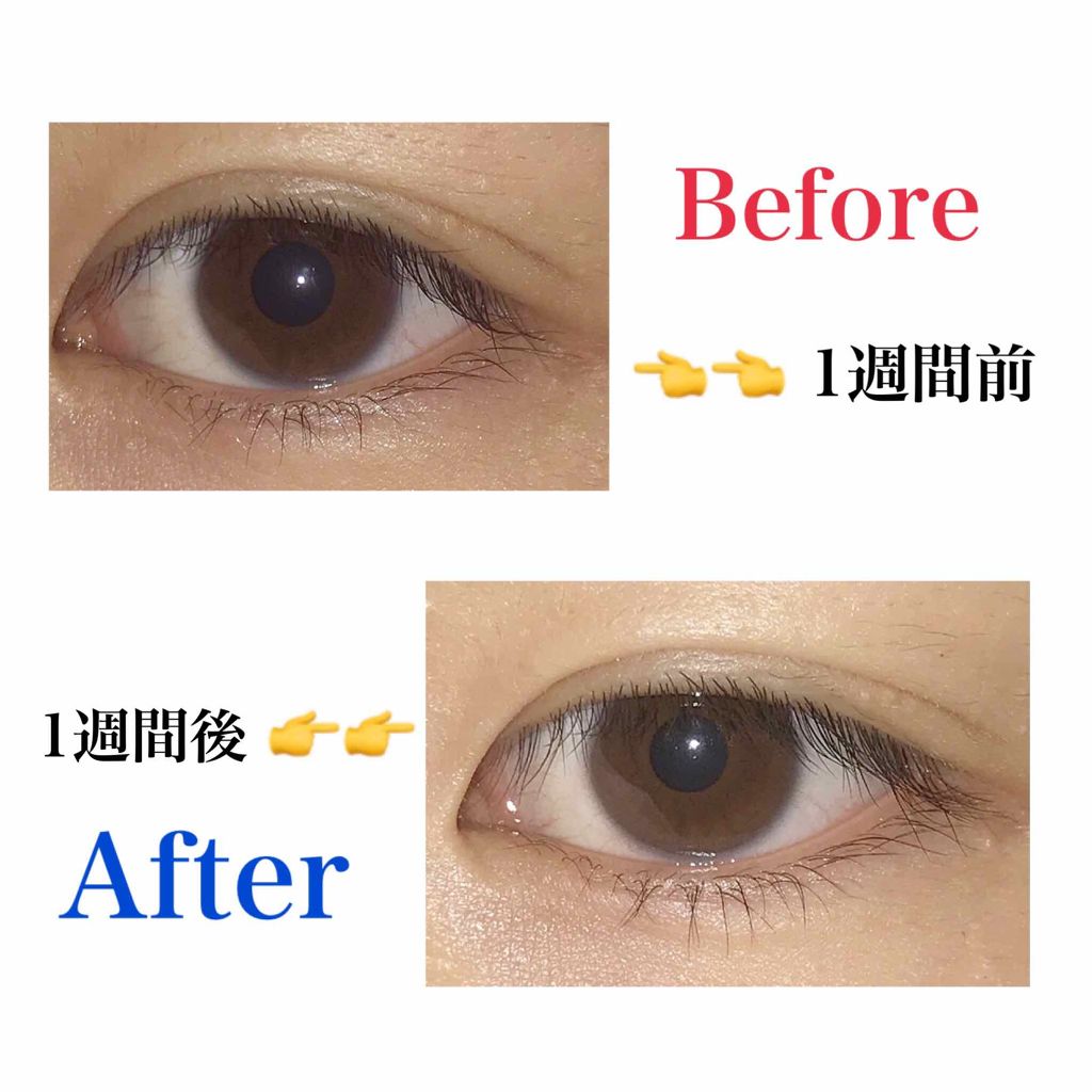 ローヤルゼリー配合 栄養ローション/DAISO/美容液を使ったクチコミ(2枚目)