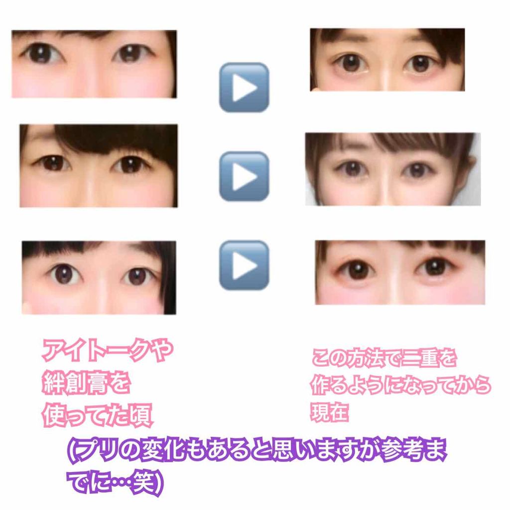 のび〜る アイテープ 両面テープタイプ/DAISO/二重まぶた用アイテムを使ったクチコミ(4枚目)